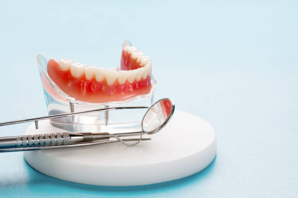 Best Wisdom Tooth Removal  in Patterson, LA